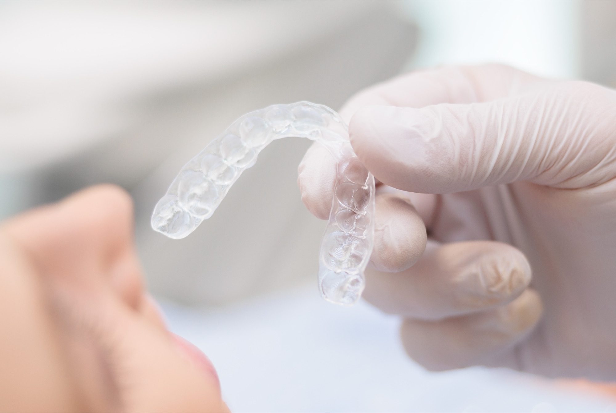 Transparente Aligner-Schiene wird der Patientin gezeigt